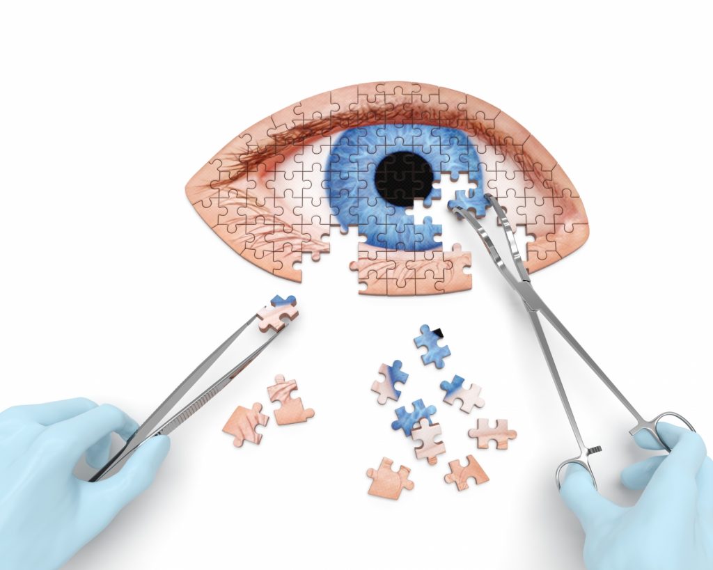 Cataract Surgery in Daytona Beach