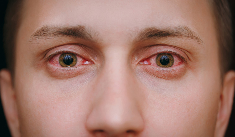 Eye Care in Holly Hill
